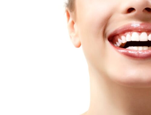 Implant Dentist in Niles