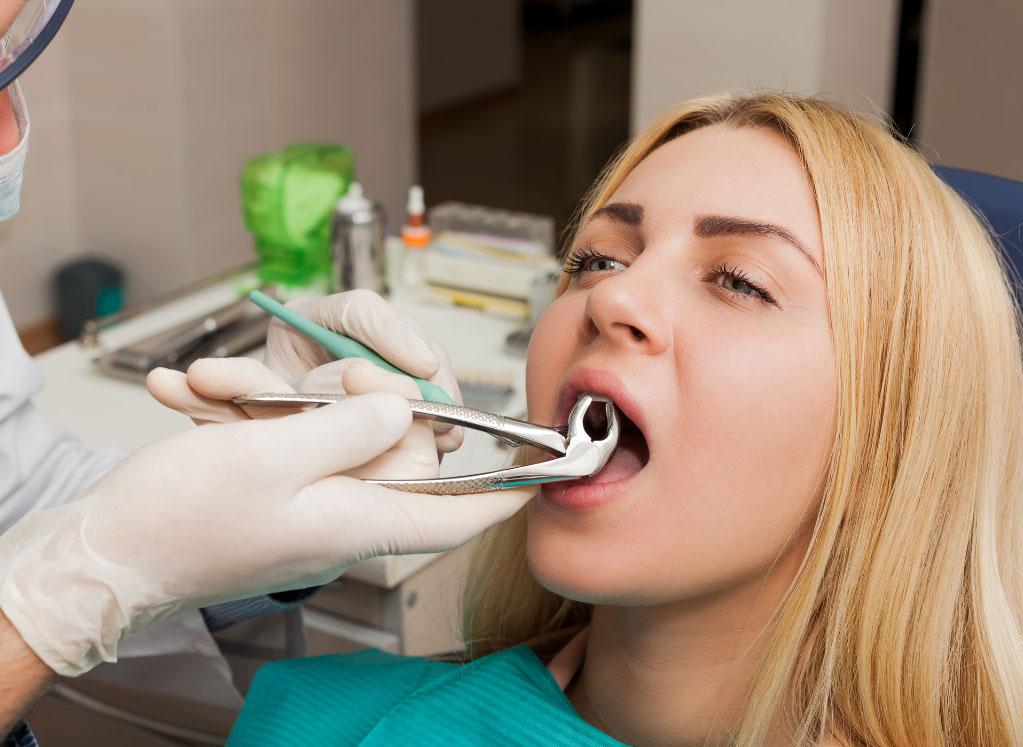 Tooth-Extractions2 Tooth Extractions